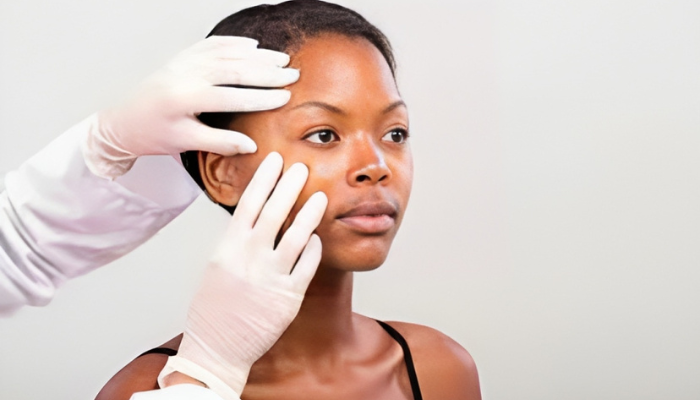 Seeking Professional Acne Treatment Help: