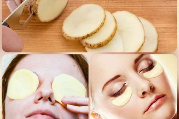 potato face pack